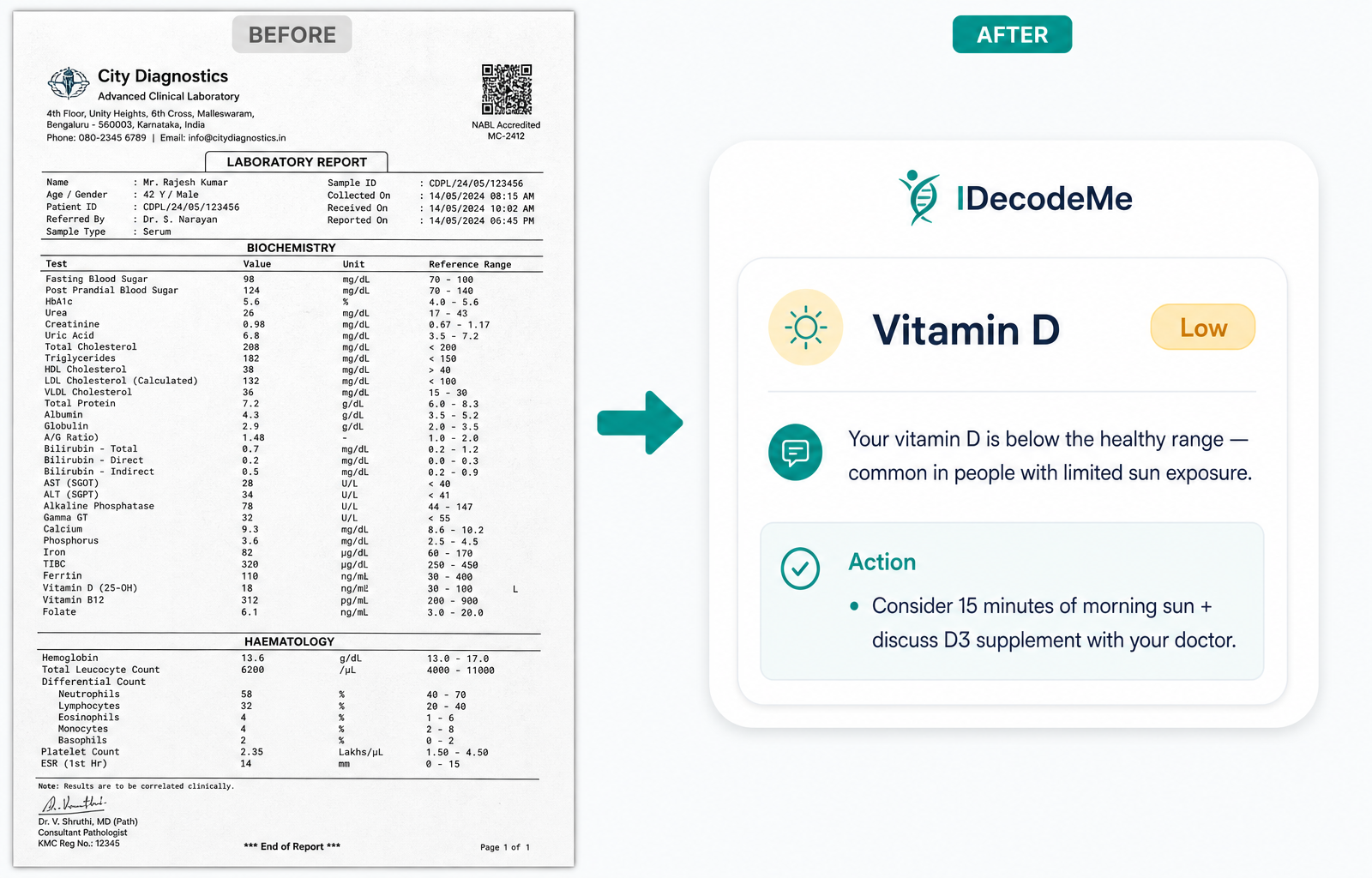 A raw lab PDF on the left and a decoded iDecodeMe insight card on the right